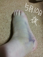 20170510173729705.jpg